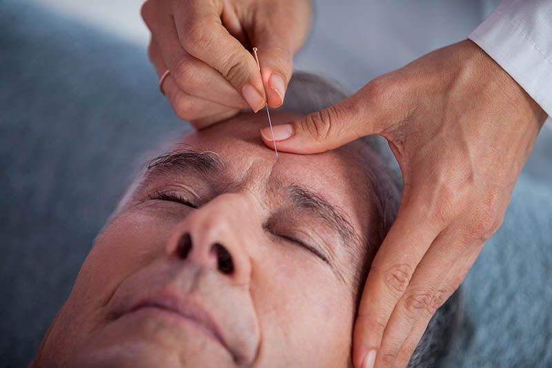 Kan akupunktur forebygge migrene? / 2020 / Helsemagasinet vitenskap og fornuft