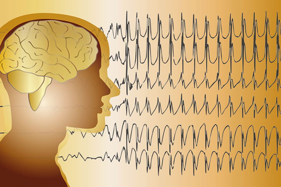Kan glyfosat gi epilepsi? Glyfosat er den aktive ingrediensen i Roundup / epilepsi / Helsemagasinet vitenskap og fornuft