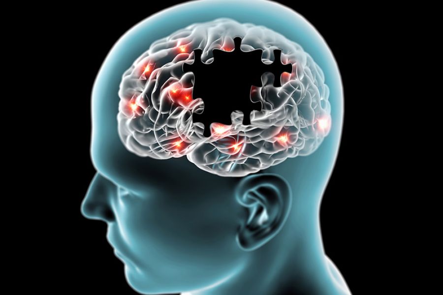 Alzheimers sykdom – mer enn plakk i hjernen / Alzheimers sykdom / Helsemagasinet vitenskap og fornuft
