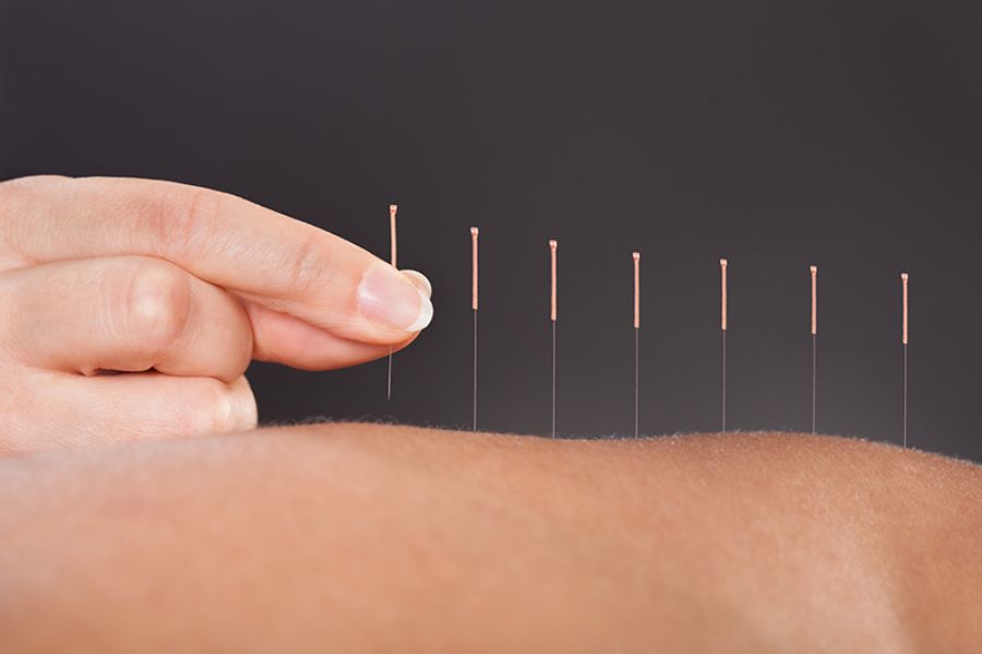 Akupunktur effektivt mot motorisk afasi etter slag / akupunktur / Helsemagasinet vitenskap og fornuft