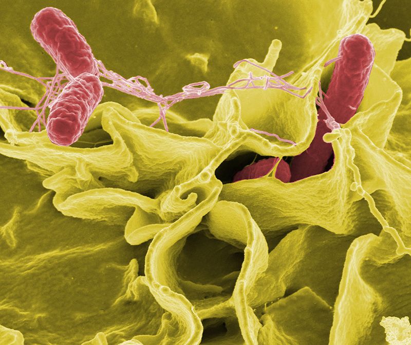 Virus og bakterier - sykdomsårsaker? / 2011 / Helsemagasinet vitenskap og fornuft