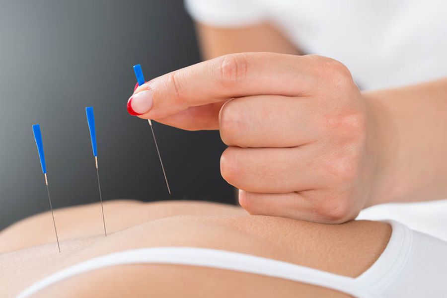 Akupunktur effektivt mot motorisk afasi etter slag / akupunktur / Helsemagasinet vitenskap og fornuft