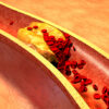”Dårlig” LDL-kolesterol motvirker infeksjoner / 2010 / Helsemagasinet vitenskap og fornuft