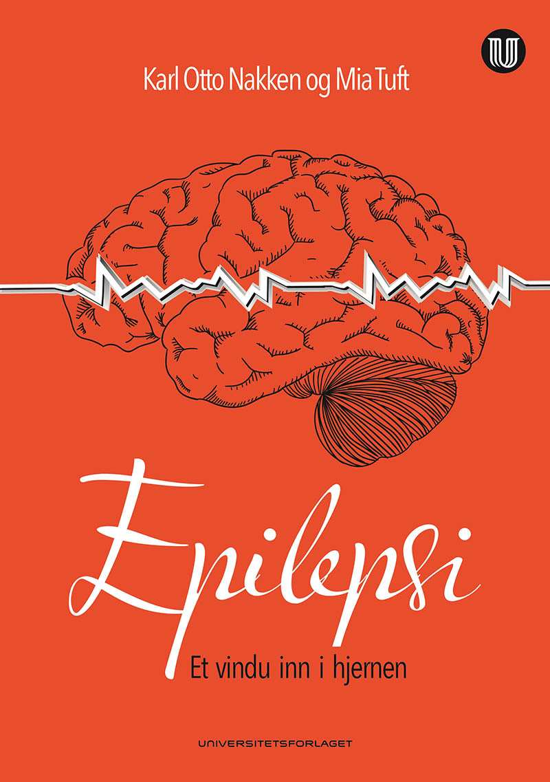 Glimrende om epilepsiens historie / 2021 / Helsemagasinet vitenskap og fornuft